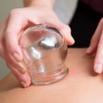 CUPPING-MASSAGE-1000-1